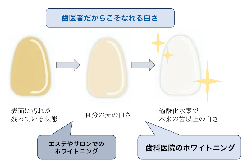 １回で白さを実感できる